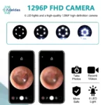 Wireless Ear Wax Removal Cleaner with Camera Singapore - Image 5